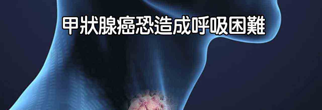 中醫甲狀腺癌治療