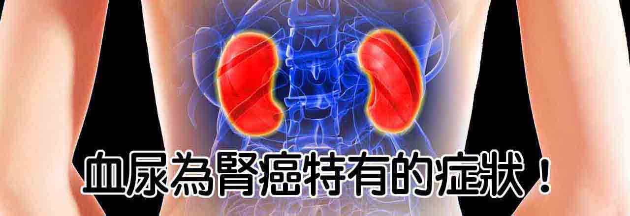 中醫腎臟癌治療